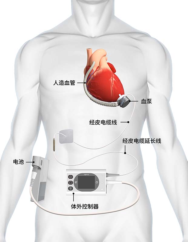 久久久www成人免费无遮挡大片